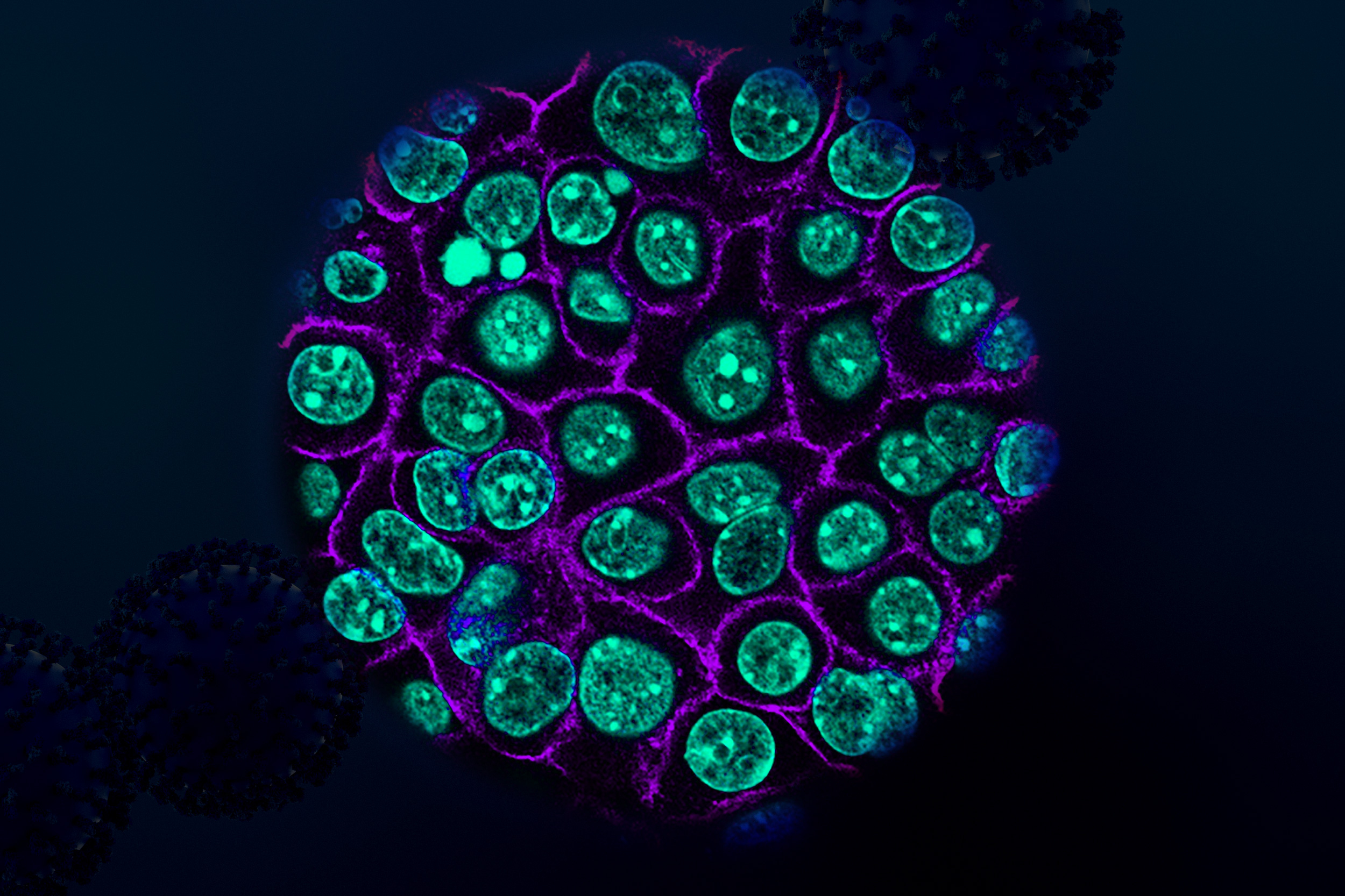 Biologové identifikovali cíle pro nové léčby rakoviny slinivky břišní